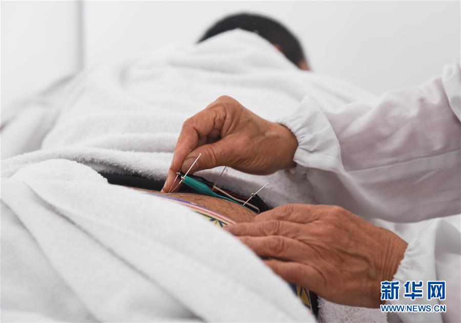 周克秀:用針灸為秘魯人民消病除痛的中國醫生(組圖)