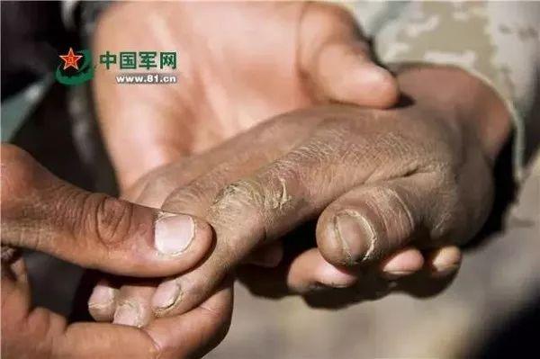 【我和軍隊(duì)的不解之緣】你是人間的大英雄!