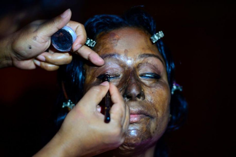 遭硫酸毀容女性走秀 重新定義美[組圖]