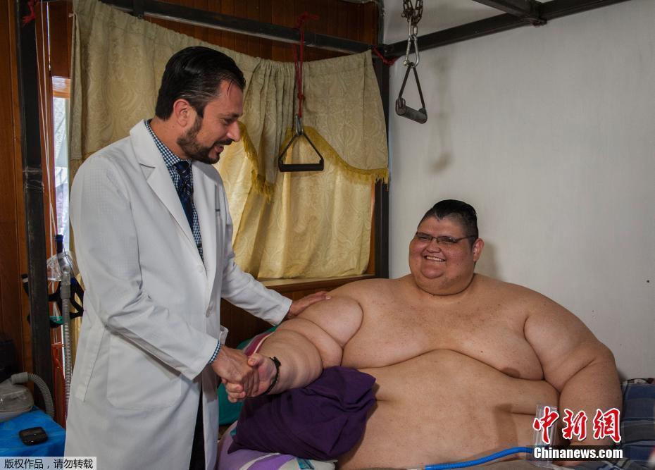 墨西哥男子體重曾達半噸 網友：有點像米其林(圖)