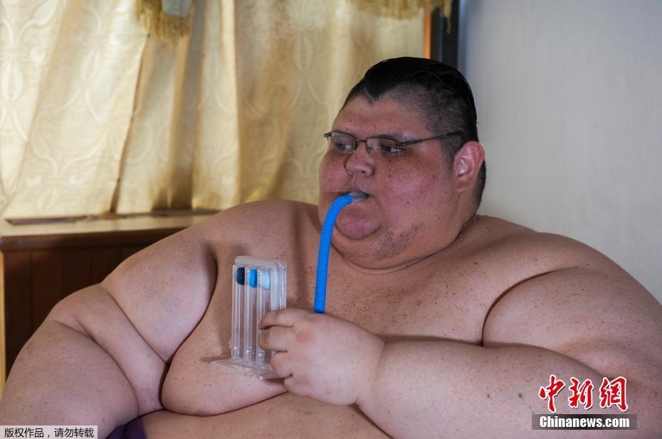 墨西哥男子體重曾達半噸 網友：有點像米其林(圖)