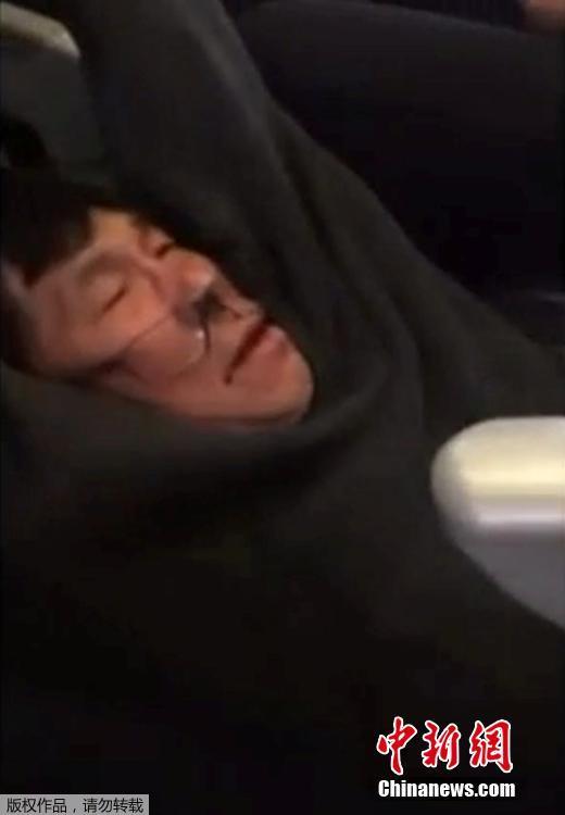 美聯航CEO致歉被拖拽乘客 近13億美元市值蒸發